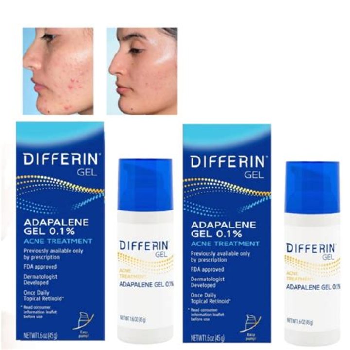 Differin Before and After: Transforming Your Skin with Retinoid Power