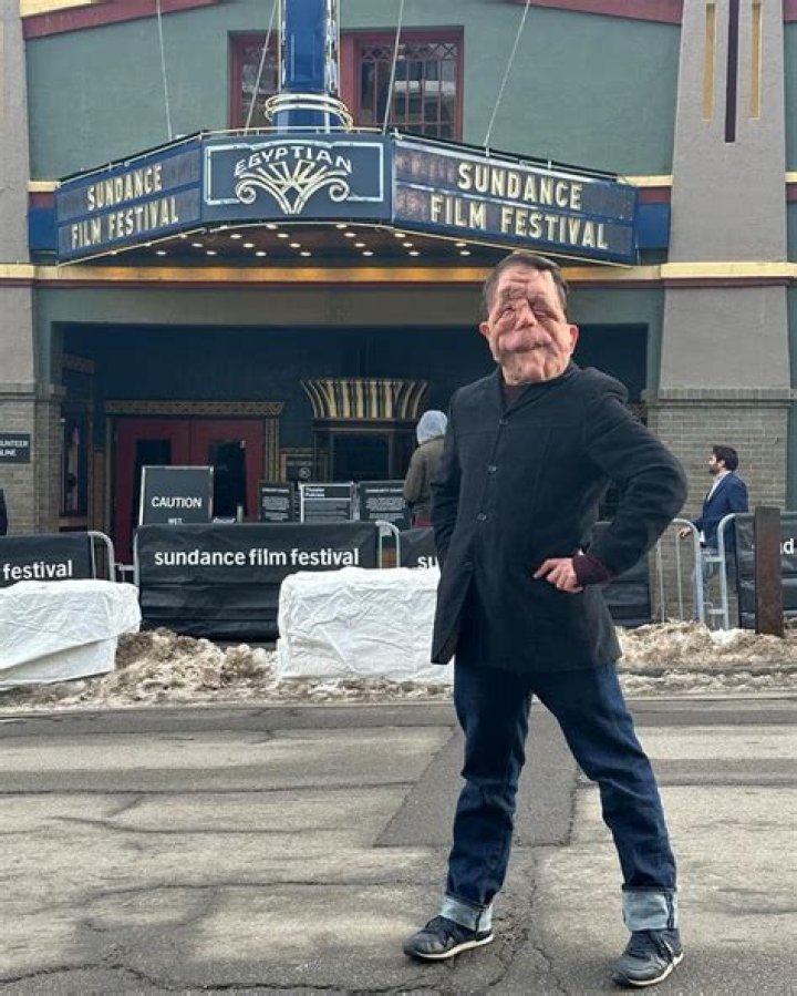Discovering Adam Pearson's Height: The Man Behind the Screen
