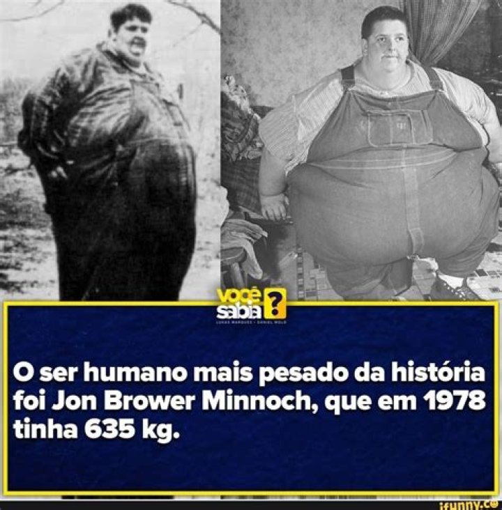 Jon Brower Minnoch: The Story of the Heaviest Man in Medical History