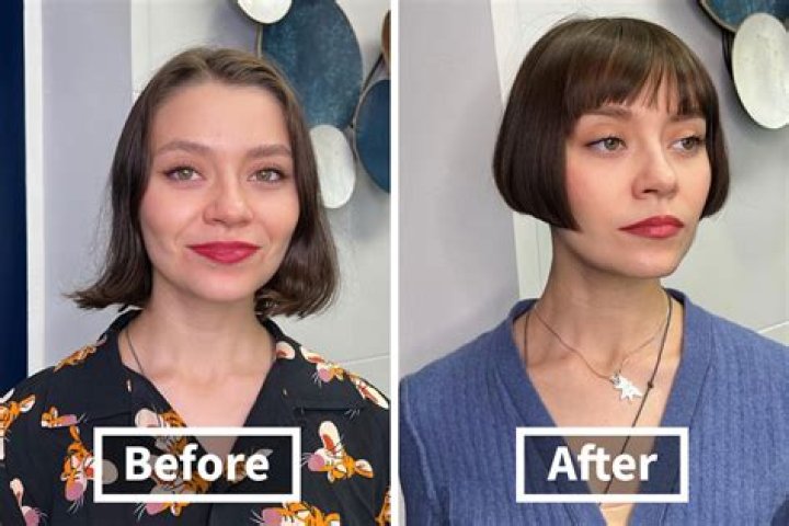 Lyn May: A Journey of Transformation - Before and After