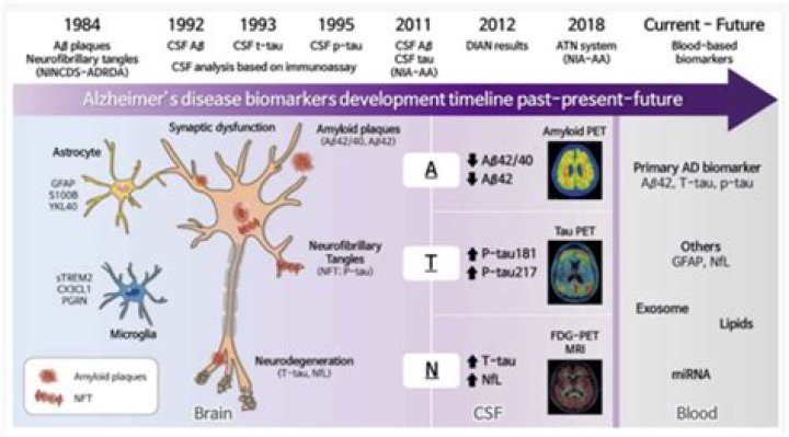 The Revolutionary Role of Alzheimer Biomarkers in Early Detection and Treatment
