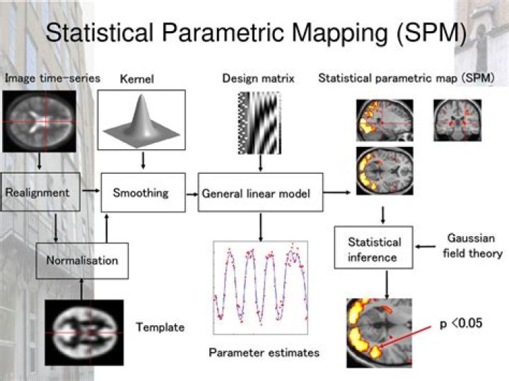 Understanding SPM Age: A Comprehensive Guide to Statistical Parametric Mapping in Neuroimaging