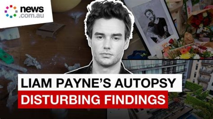 Unveiling the Educational Journey of Liam Payne